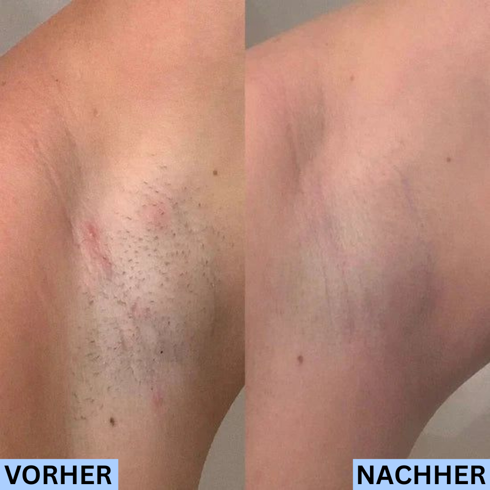 Olyora Post-Shave Perfection