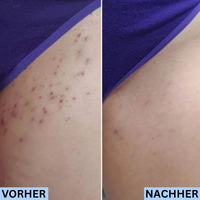 Olyora Post-Shave Perfection